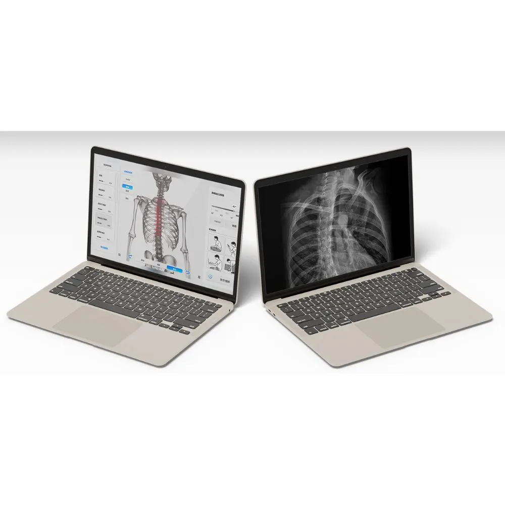 Fiziosan Analisi postura Moti Physio sistema 3D statica dinamica