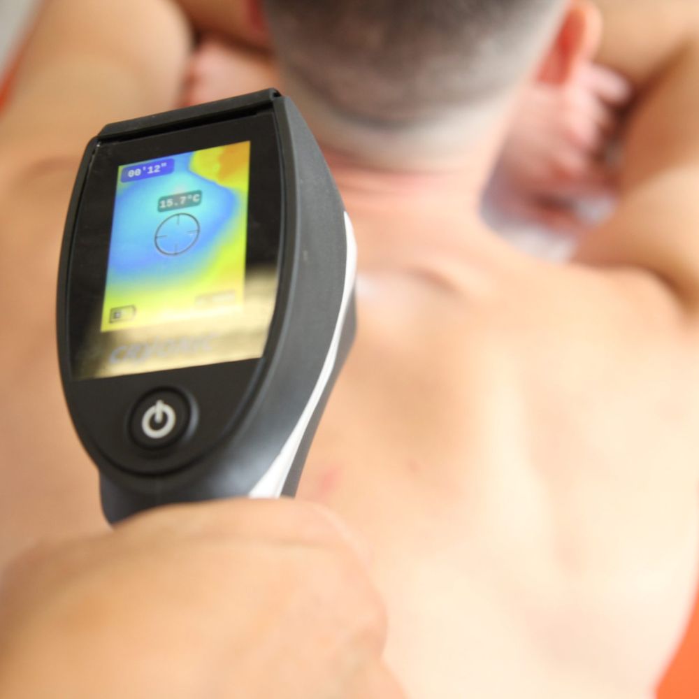 Fiziosan Cryoscreen dispositivo crioterapia CO2 portatile