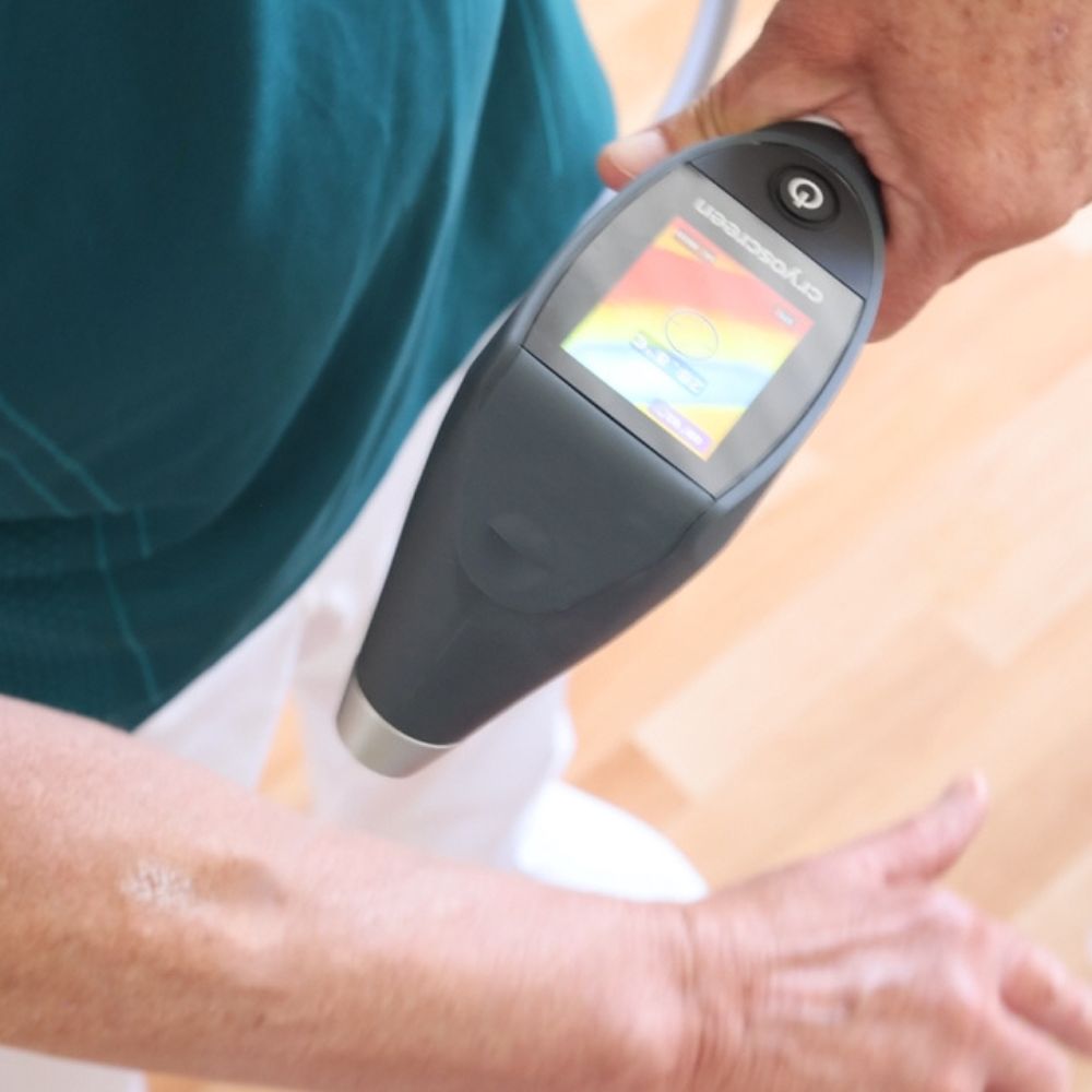 Fiziosan Cryoscreen dispositivo crioterapia CO2 portatile