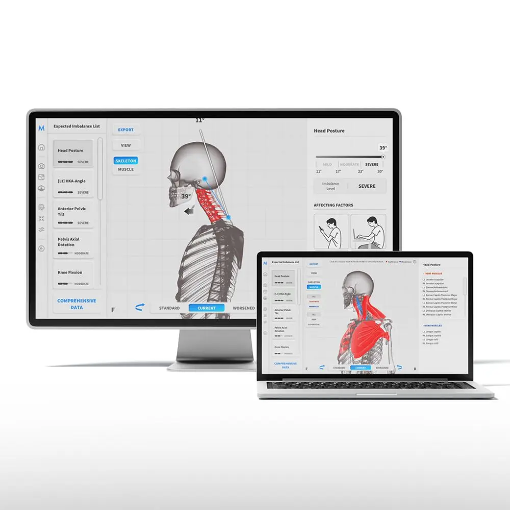 Fiziosan Analisi postura Moti Physio sistema 3D statica dinamica