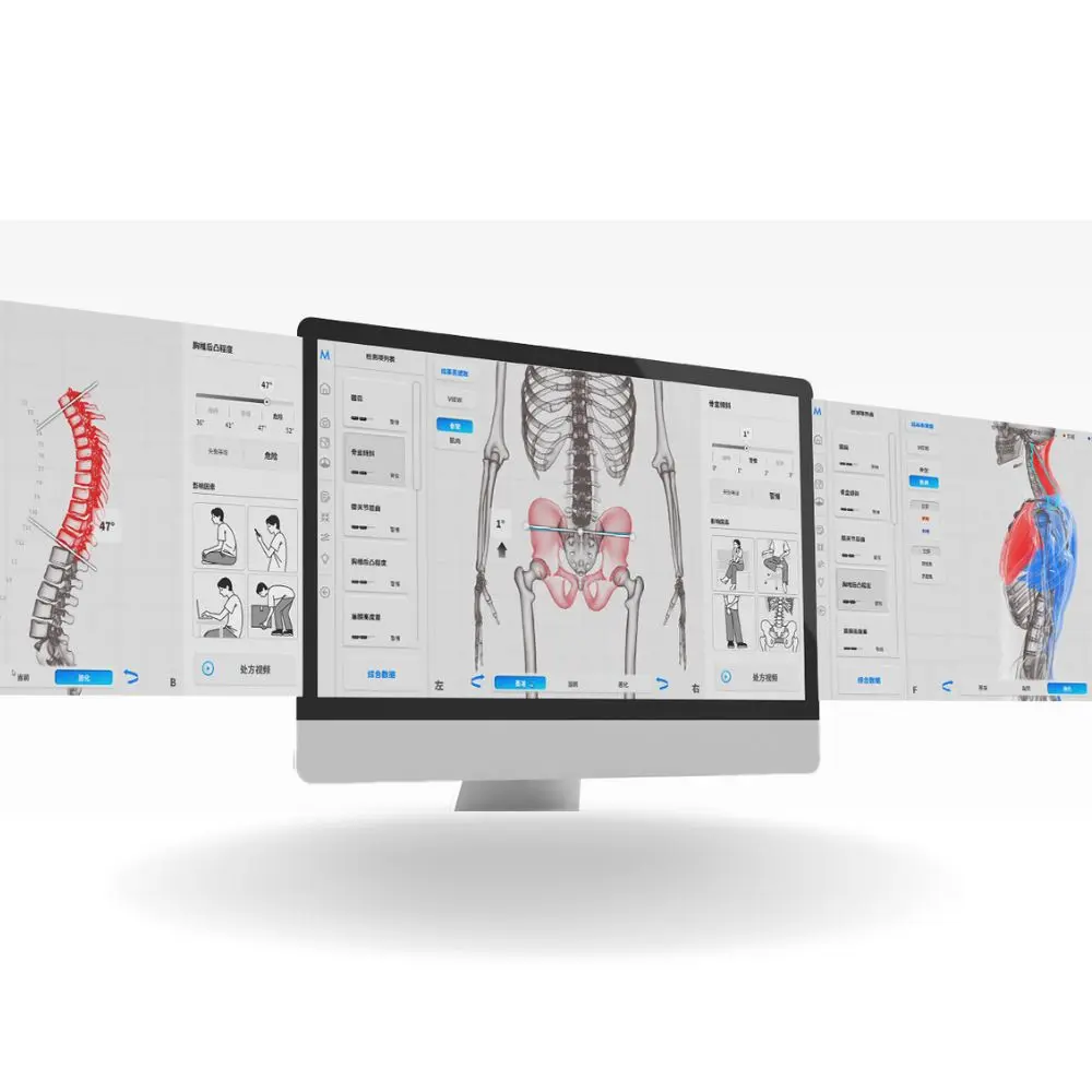 Fiziosan Analisi postura Moti Physio sistema 3D statica dinamica